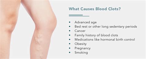 Using CT Scans for Finding Blood Clots | Envision Radiology