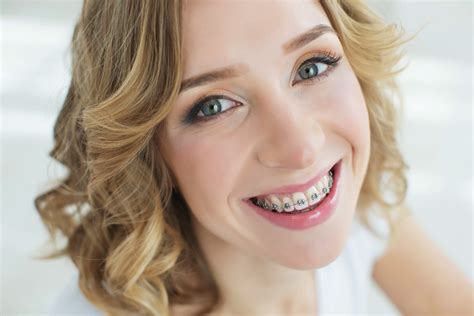 Big Benefits of Braces in Your Adult Years - Doyle Orthodontics