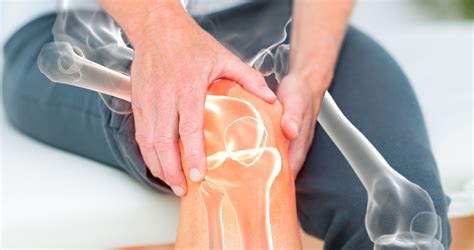 Condropatia rotulea | Osteoplus®