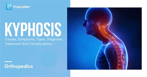 Kyphosis: Causes, Symptoms, Types, Diagnosis, Treatment and Complications