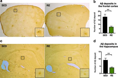 Immunochemical staining of amyloid plaques. a, c Representative images ...