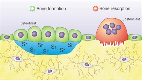 Effects of strontium ranelate on bone. Strontium ranelate promotes bone ...