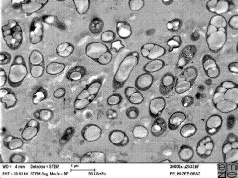 Electron microscopic picture of PHA-rich cells of Cupriavidus necator ...