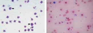 Babesia bigemina in Giemsa stained blood smear (Paired at acute angle ...