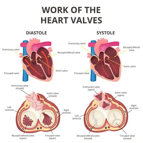 Leaky Heart Valve: Symptoms, Causes, and Treatments – Page 12 ...