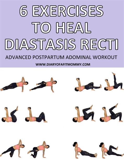 6 Exercises to Fix & Heal Diastasis Recti | ADVANCED Postpartum ...