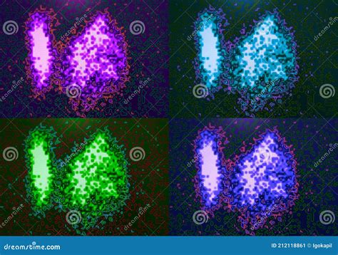 Colorful Nuclear Medicine Thyroid Scan Diagnostic Stock Image - Image ...