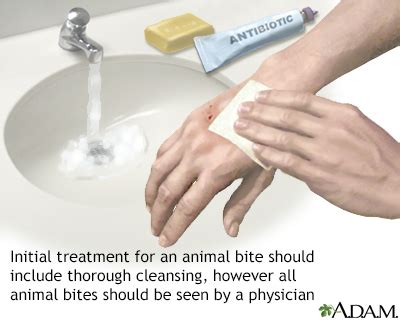 Do Dog Bites Need Antibiotics