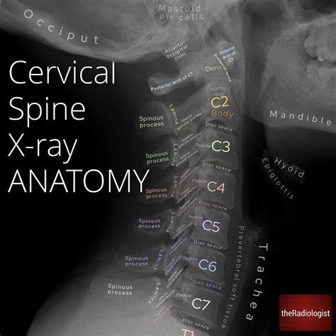 Radiographic Anatomy Of The Cervical Spine Quick Version – NBKomputer