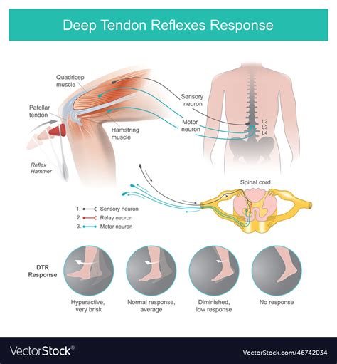 Where To Check Deep Tendon Reflexes