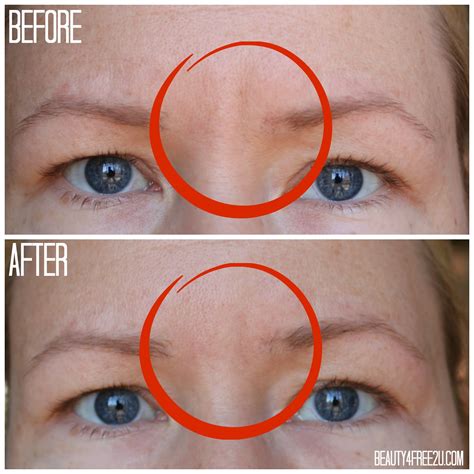 Instantly Ageless: the best instant wrinkle filler for the under-eye area?