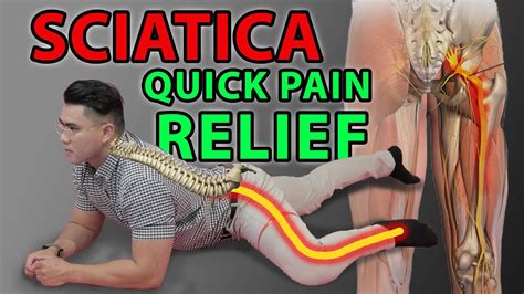 One Minute Sciatica Exercise to Cure Sciatica & Quick Pain Relief | Leg ...