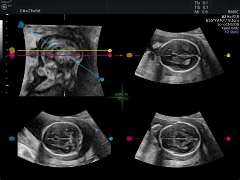 Gynecology Ultrasound Course - Gynaecology Ultrasound Courses ...