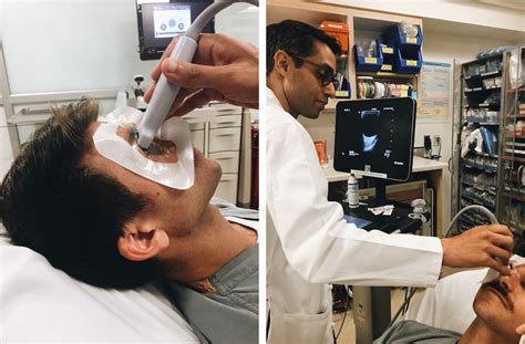 ocular ultrasound setup | ALiEM