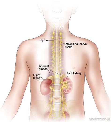 Neuroblastoma Treatment (PDQ®) - NCI