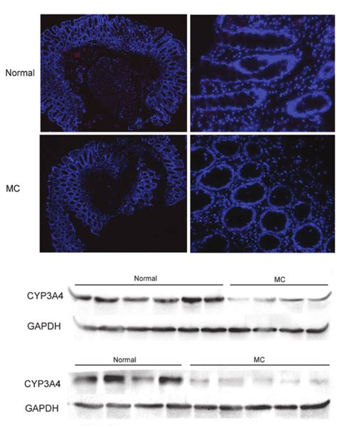 Elevated expression of CYP3A4 in MC and normal tissues. (A ...