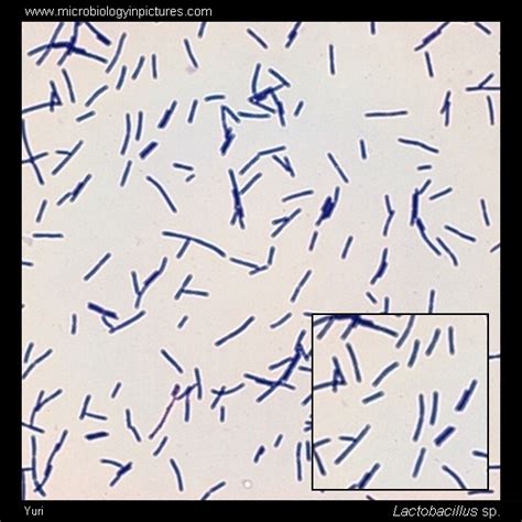 Lactobacillus Gram-stain and cell morphology. Lactobacillus micrograph ...