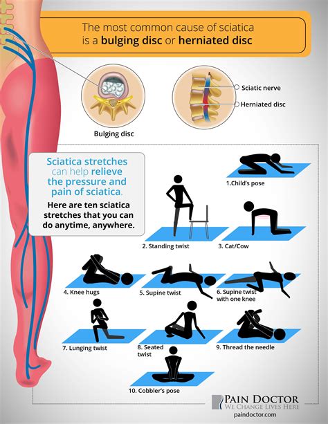 infographic - sciatica stretches | Sciatica stretches, Sciatic nerve ...