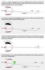 What is Vertical Heterophoria? | The Neuro Visual Center of NY