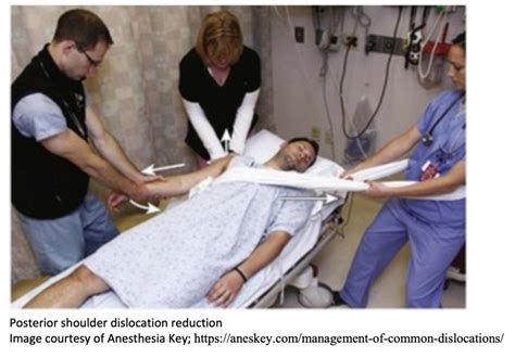 emDOCs.net – Emergency Medicine EducationEM@3AM: Posterior Shoulder ...