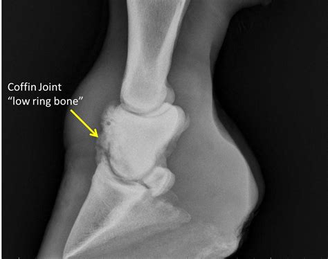 Michael Porter, Equine Veterinarian: High Ring Bone!!