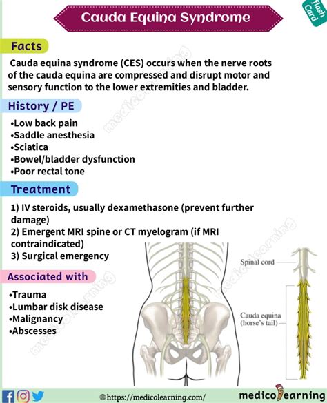 Cauda equina syndrome – MedicoLearning