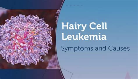 Hairy Cell Leukemia: Symptoms and Causes | MyLeukemiaTeam