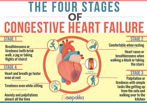 Stages of Heart Failure – St. Anthony's Hospice