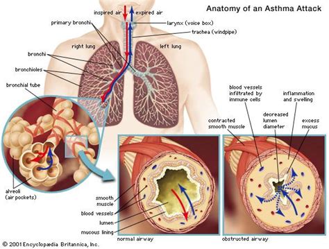 Respiratory disease | Definition, Causes, & Major Types | Britannica