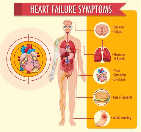 Congestive Heart Failure Patient