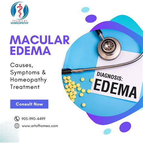 Macular Edema: Causes, Symptoms & Homeopathy Treatment - Art Of Homeopathy