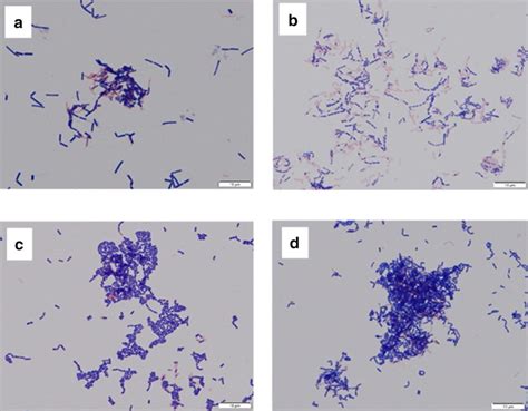 Gram stain of the four species of Lactobacilli at 0 h. aL. crispatus ...