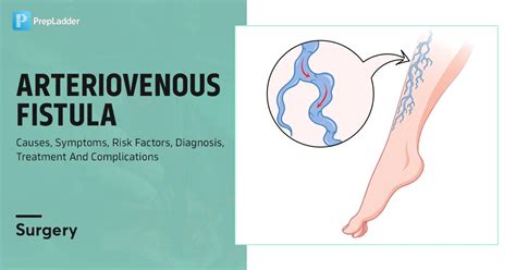 Arteriovenous Fistula : Causes, Symptoms, Risk Factors, Diagnosis ...