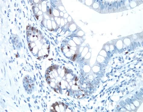 DAB Staining, DAB Peroxidase Substrate Kit | Vector Labs