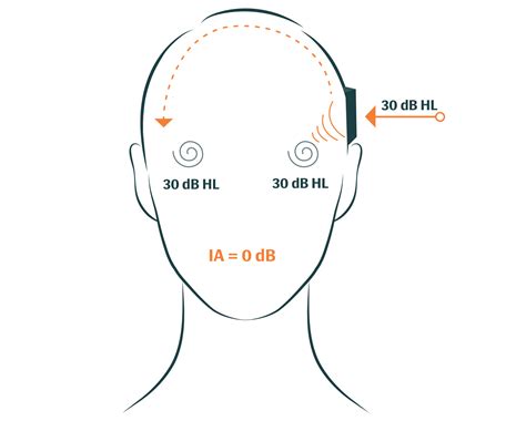 Bone Conduction Testing: What is Bone Conduction?