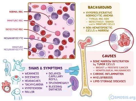 Myelophthisic Anemia: What Is It, Diagnosis | Osmosis