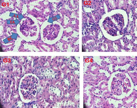 Histopathology of renal Corpuscles. EA, efferent artery; AA, afferent ...