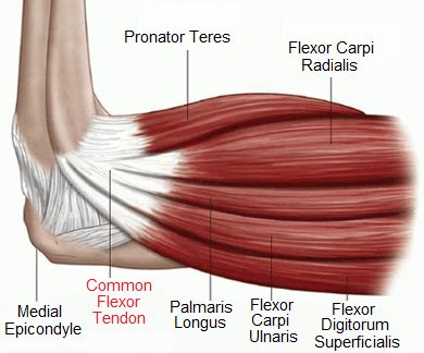 Golfers Elbow (Medial Epicondylitis): Causes, Symptoms & Treatment