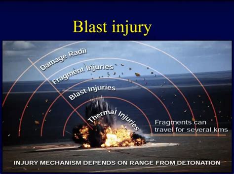 Orthopaedic Blast Injuries: Blast wave mechanics ...