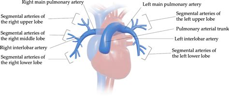 The pulmonary artery and its branches. | Download Scientific Diagram