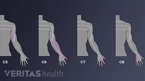 Dermatomes Arm Hand Anatomy