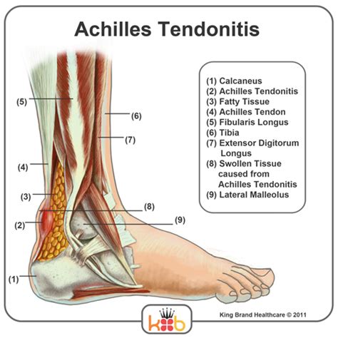 [DIAGRAM] Forearm Tendon Diagram - MYDIAGRAM.ONLINE