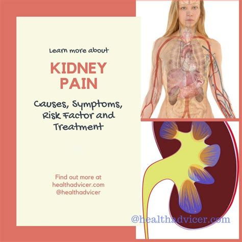 Kidney Pain Chart