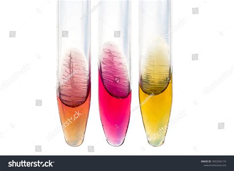 5 Simmons Citrate Agar Images, Stock Photos & Vectors | Shutterstock