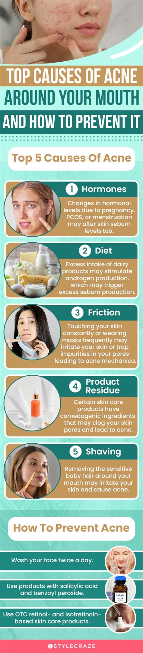 What Do Pimples Near Your Mouth Mean - Infoupdate.org