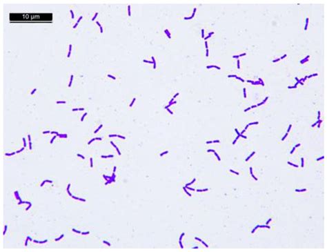 Lactobacillus Casei Gram Stain