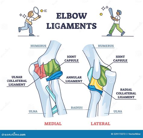 Elbow Ligaments With Medical Medial Or Lateral Xray Structure Outline ...