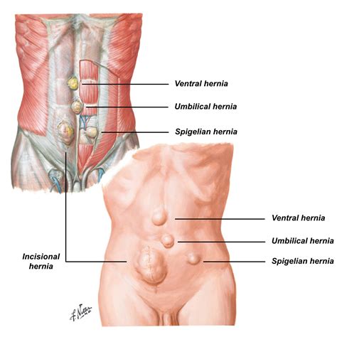 General Surgery | Perth Weight Loss Surgery