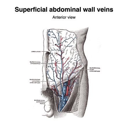 Superior Epigastric Artery Anastomosis