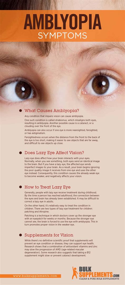 Tablo | Read 'Amblyopia (Lazy Eye) Symptoms, Diagnosis, and Treatment' by